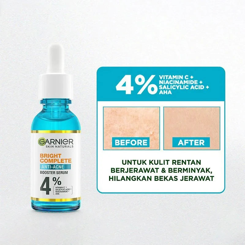 30ml Whitening Essence Removes Acne Marks Comedones Blackheads Facial Repair Serum Shrinks Pores Moisturizes Essence